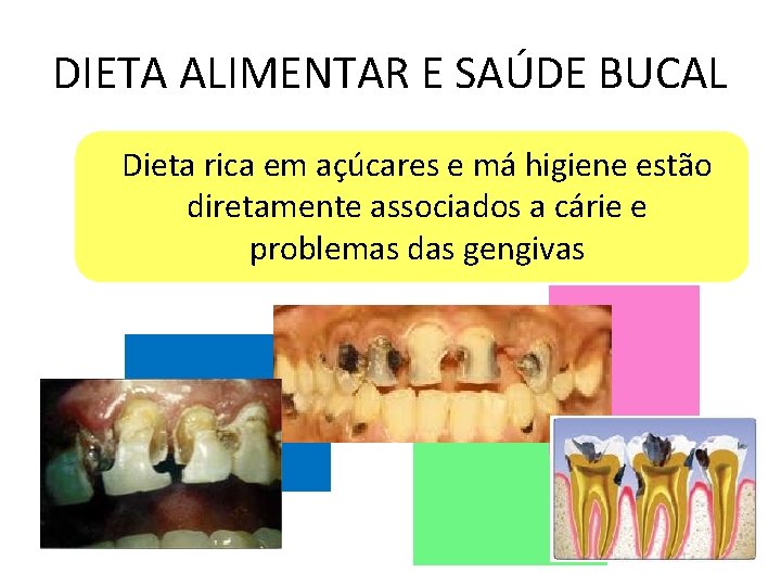 DIETA ALIMENTAR E SAÚDE BUCAL Dieta rica em açúcares e má higiene estão diretamente