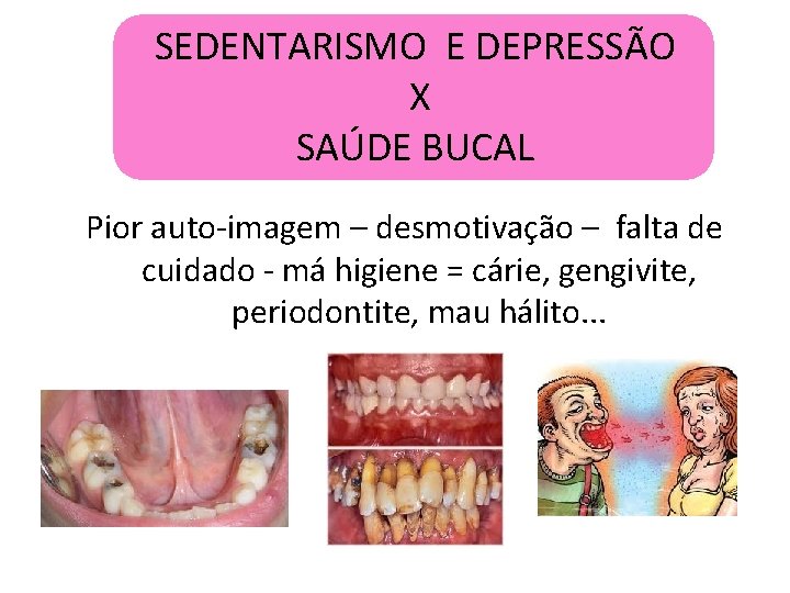 SEDENTARISMO E DEPRESSÃO X SAÚDE BUCAL Pior auto-imagem – desmotivação – falta de cuidado