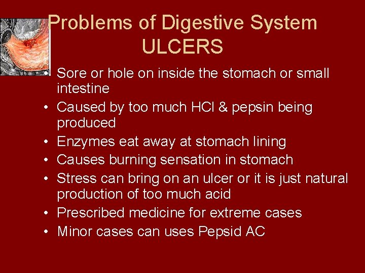 Problems of Digestive System ULCERS • Sore or hole on inside the stomach or