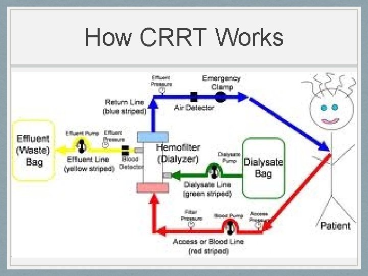 How CRRT Works 