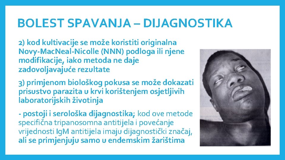 BOLEST SPAVANJA – DIJAGNOSTIKA 2) kod kultivacije se može koristiti originalna Novy-Mac. Neal-Nicolle (NNN)