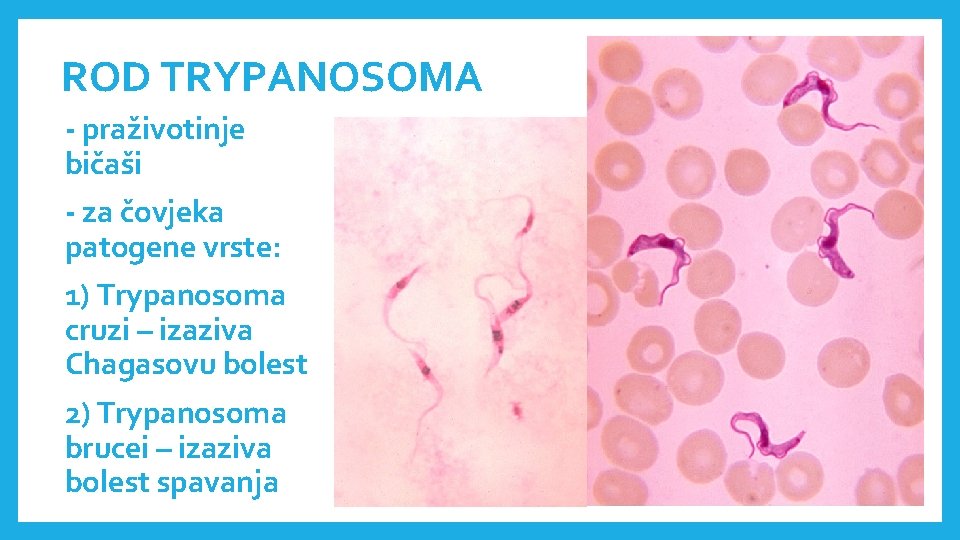 ROD TRYPANOSOMA - praživotinje bičaši - za čovjeka patogene vrste: 1) Trypanosoma cruzi –