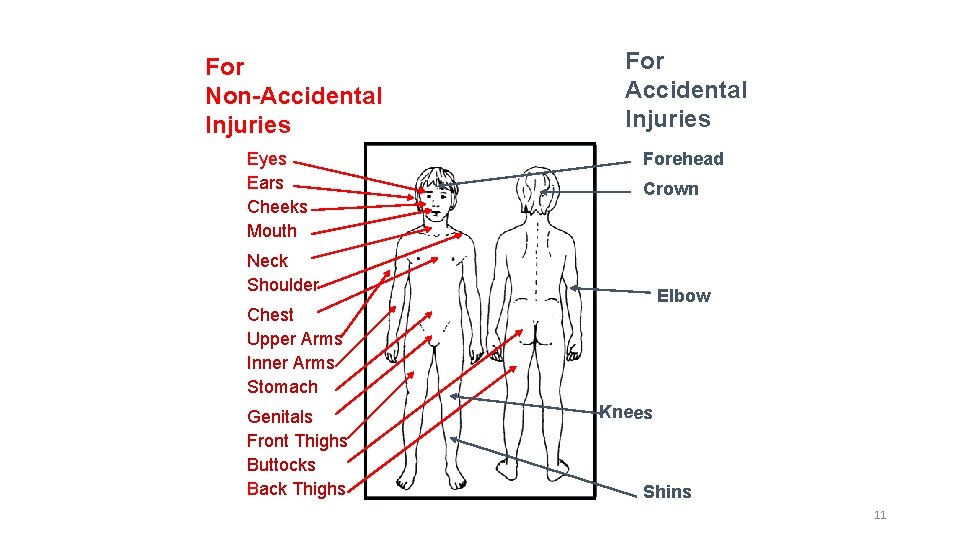 For Non-Accidental Injuries Eyes Ears Cheeks Mouth For Accidental Injuries Forehead Crown Neck Shoulder