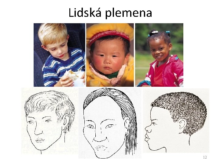 Lidská plemena Soustava kožní 12 Lidská plemena Soustava kožní 12