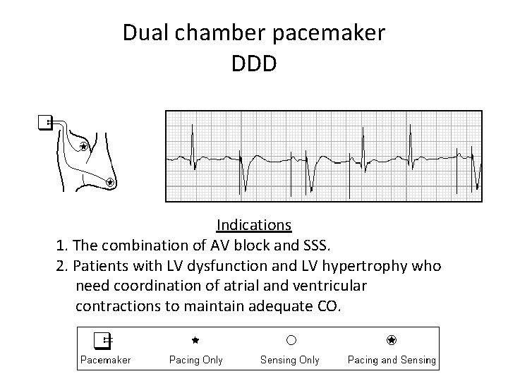 Dual chamber pacemaker DDD Indications 1. The combination of AV block and SSS. 2.