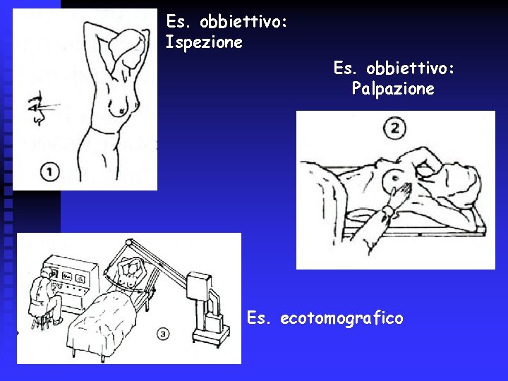 Es. obbiettivo: Ispezione Es. obbiettivo: Palpazione Es. ecotomografico 