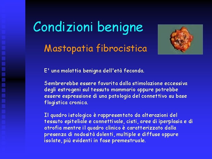 Condizioni benigne Mastopatia fibrocistica E' una malattia benigna dell'età feconda. Sembrerebbe essere favorita dalla