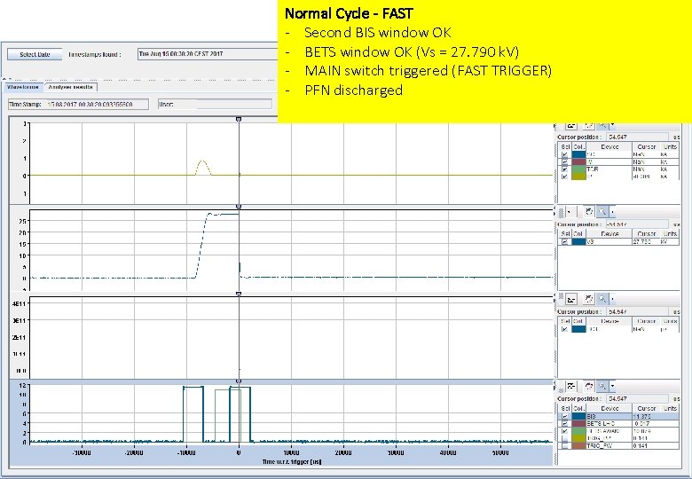 Normal Cycle - FAST - Second BIS window OK - BETS window OK (Vs