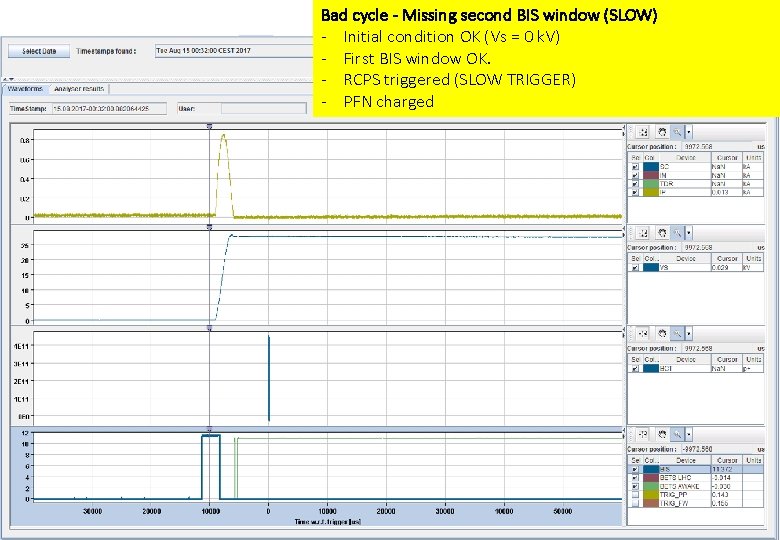 Bad cycle - Missing second BIS window (SLOW) - Initial condition OK (Vs =