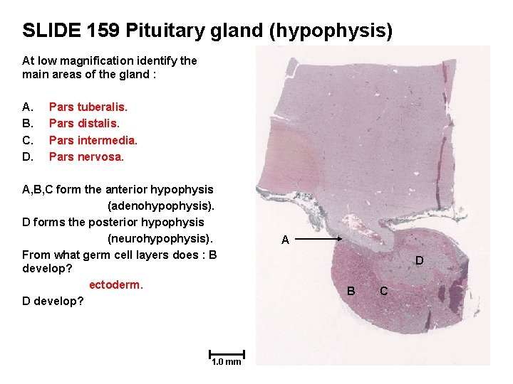 SLIDE 159 Pituitary gland (hypophysis) At low magnification identify the main areas of the