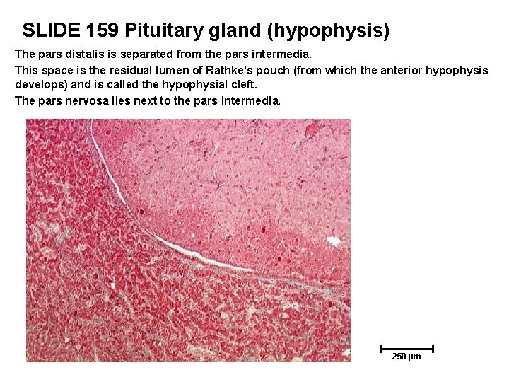 SLIDE 159 Pituitary gland (hypophysis) The pars distalis is separated from the pars intermedia.