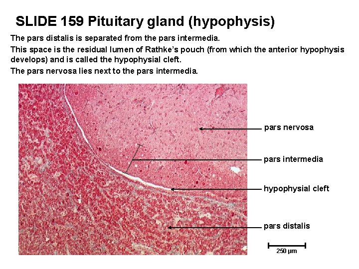 SLIDE 159 Pituitary gland (hypophysis) The pars distalis is separated from the pars intermedia.