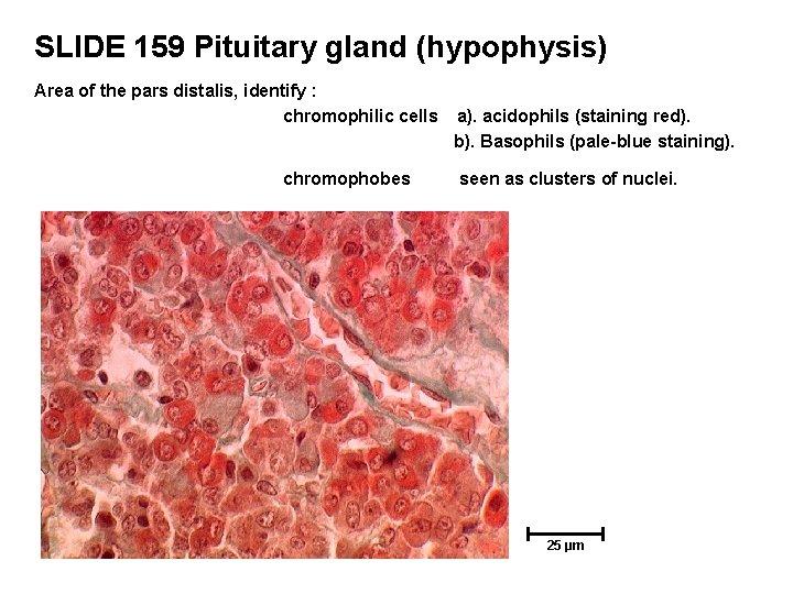 SLIDE 159 Pituitary gland (hypophysis) Area of the pars distalis, identify : chromophilic cells