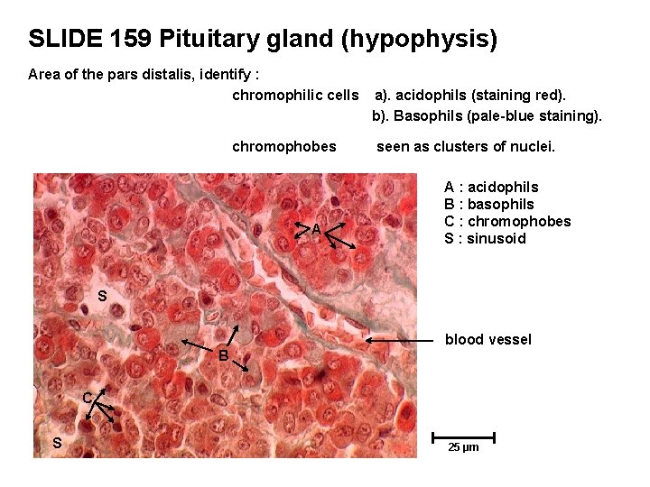 SLIDE 159 Pituitary gland (hypophysis) Area of the pars distalis, identify : chromophilic cells