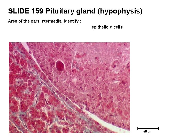 SLIDE 159 Pituitary gland (hypophysis) Area of the pars intermedia, identify : epithelioid cells