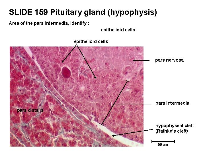 SLIDE 159 Pituitary gland (hypophysis) Area of the pars intermedia, identify : epithelioid cells