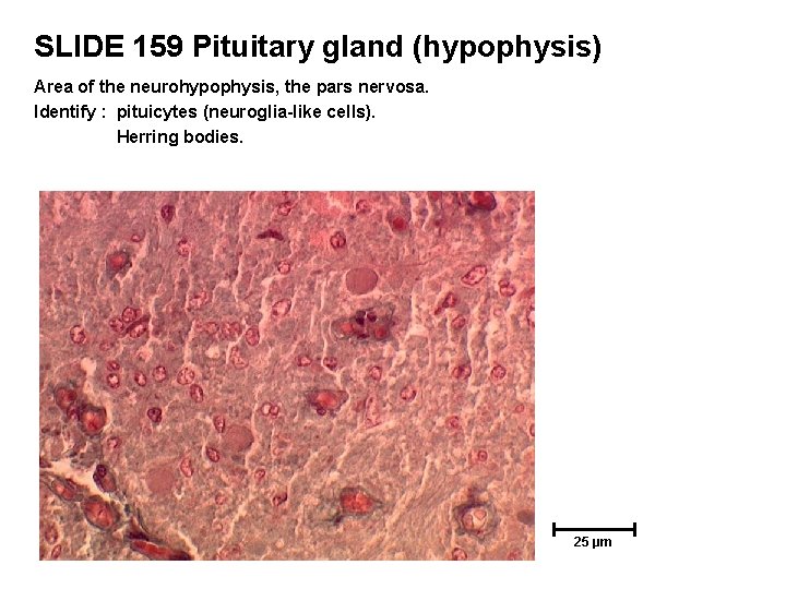 SLIDE 159 Pituitary gland (hypophysis) Area of the neurohypophysis, the pars nervosa. Identify :