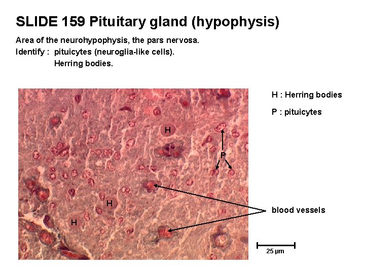 SLIDE 159 Pituitary gland (hypophysis) Area of the neurohypophysis, the pars nervosa. Identify :