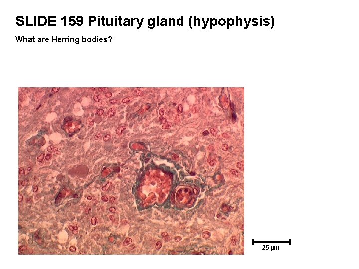 SLIDE 159 Pituitary gland (hypophysis) What are Herring bodies? 25 µm 