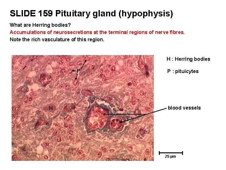 SLIDE 159 Pituitary gland (hypophysis) What are Herring bodies? Accumulations of neurosecretions at the