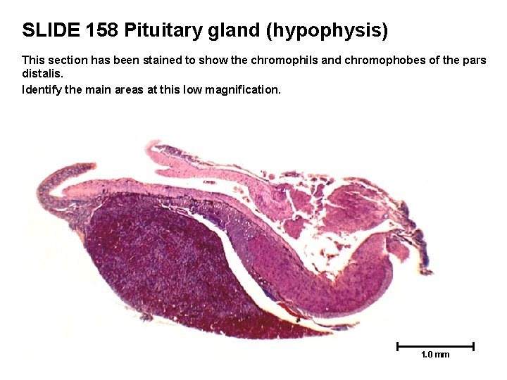 SLIDE 158 Pituitary gland (hypophysis) This section has been stained to show the chromophils