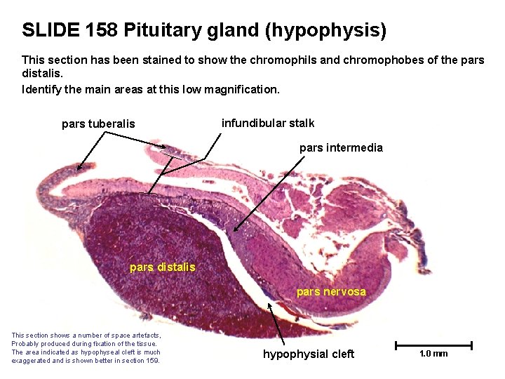 SLIDE 158 Pituitary gland (hypophysis) This section has been stained to show the chromophils