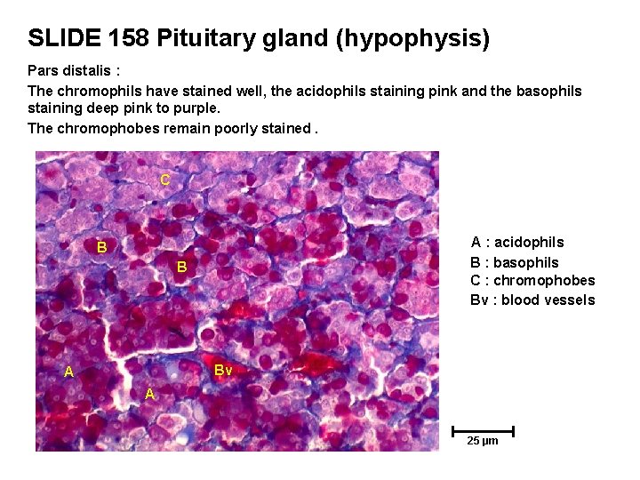 SLIDE 158 Pituitary gland (hypophysis) Pars distalis : The chromophils have stained well, the