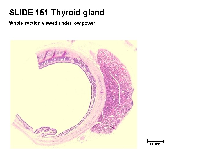 SLIDE 151 Thyroid gland Whole section viewed under low power. 1. 0 mm 