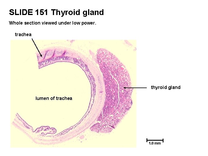 SLIDE 151 Thyroid gland Whole section viewed under low power. trachea thyroid gland lumen