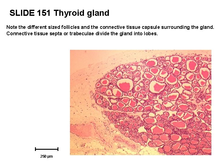SLIDE 151 Thyroid gland Note the different sized follicles and the connective tissue capsule