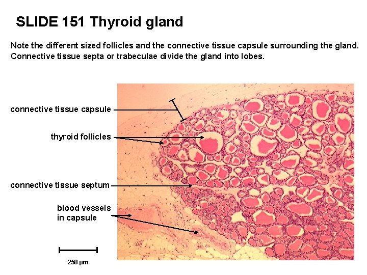 SLIDE 151 Thyroid gland Note the different sized follicles and the connective tissue capsule