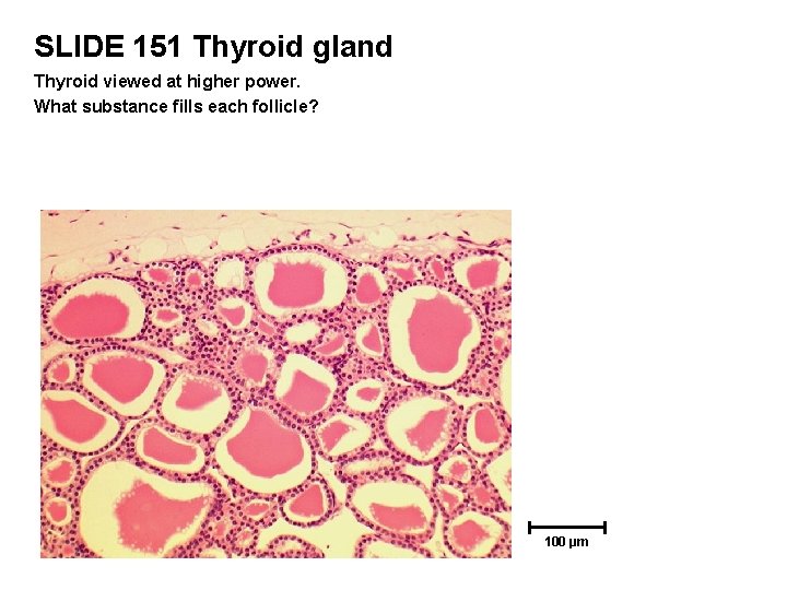 SLIDE 151 Thyroid gland Thyroid viewed at higher power. What substance fills each follicle?