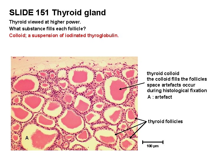 SLIDE 151 Thyroid gland Thyroid viewed at higher power. What substance fills each follicle?