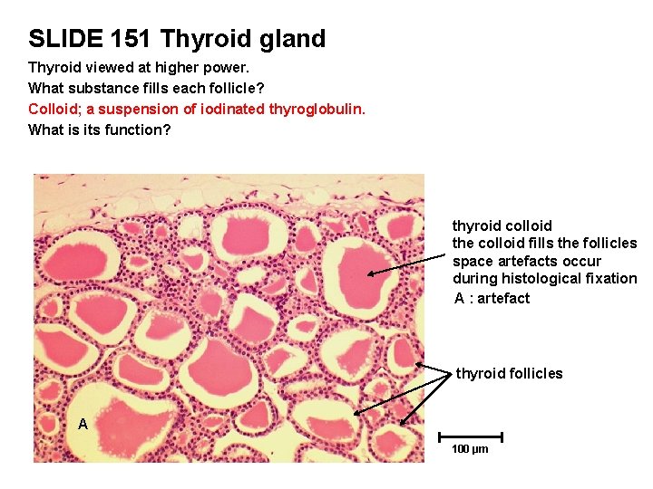 SLIDE 151 Thyroid gland Thyroid viewed at higher power. What substance fills each follicle?