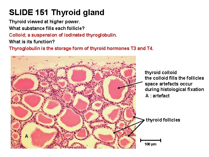 SLIDE 151 Thyroid gland Thyroid viewed at higher power. What substance fills each follicle?