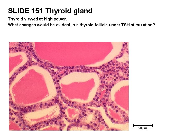 SLIDE 151 Thyroid gland Thyroid viewed at high power. What changes would be evident