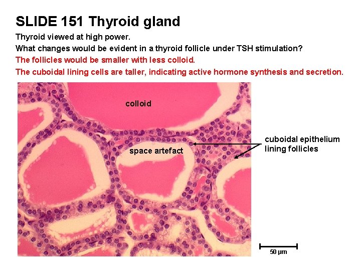 SLIDE 151 Thyroid gland Thyroid viewed at high power. What changes would be evident