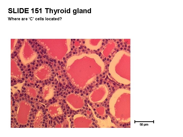 SLIDE 151 Thyroid gland Where are ‘C’ cells located? 50 µm 