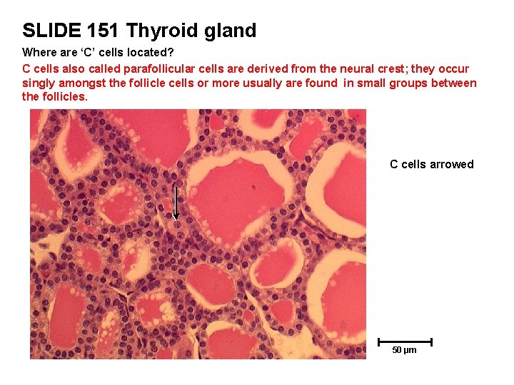 SLIDE 151 Thyroid gland Where are ‘C’ cells located? C cells also called parafollicular