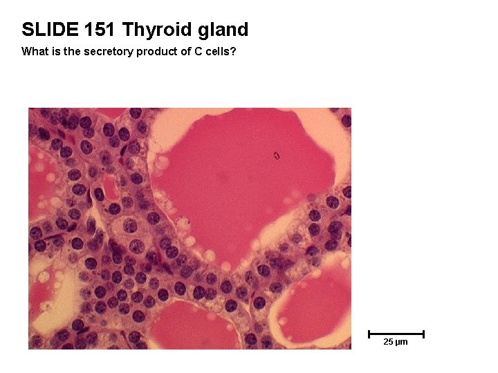 SLIDE 151 Thyroid gland What is the secretory product of C cells? 25 µm
