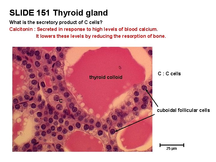 SLIDE 151 Thyroid gland What is the secretory product of C cells? Calcitonin :