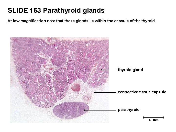 SLIDE 153 Parathyroid glands At low magnification note that these glands lie within the