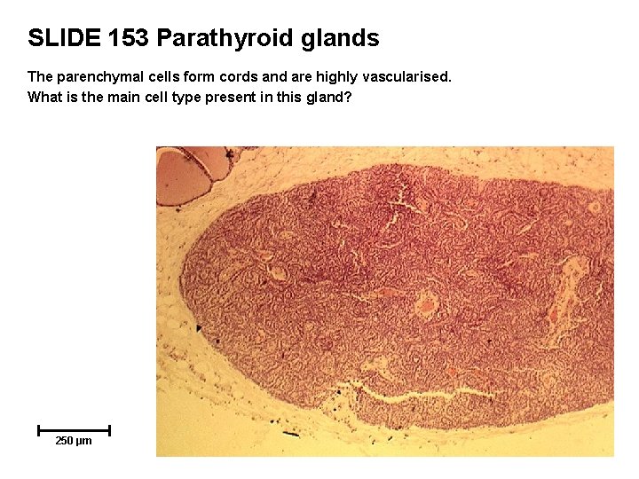 SLIDE 153 Parathyroid glands The parenchymal cells form cords and are highly vascularised. What