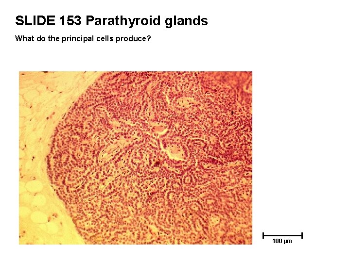 SLIDE 153 Parathyroid glands What do the principal cells produce? 100 µm 