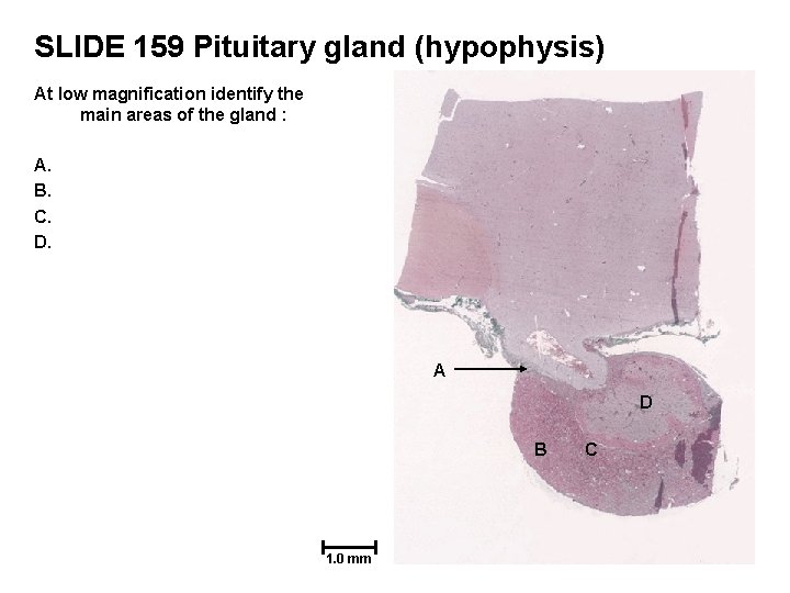 SLIDE 159 Pituitary gland (hypophysis) At low magnification identify the main areas of the