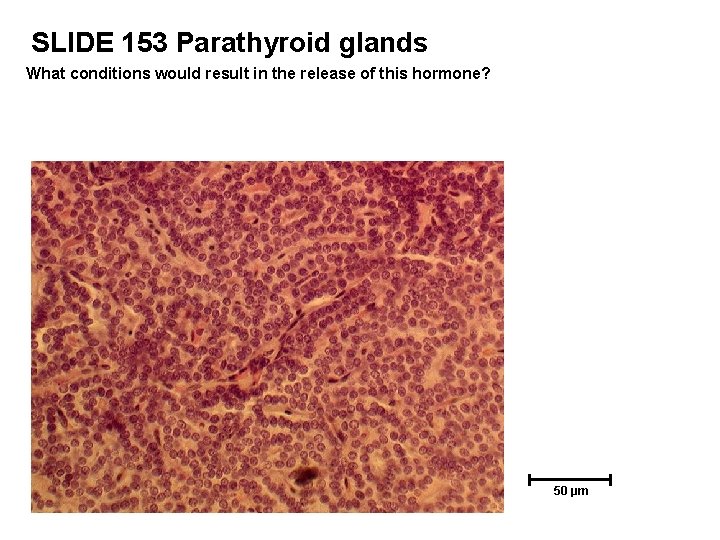 SLIDE 153 Parathyroid glands What conditions would result in the release of this hormone?