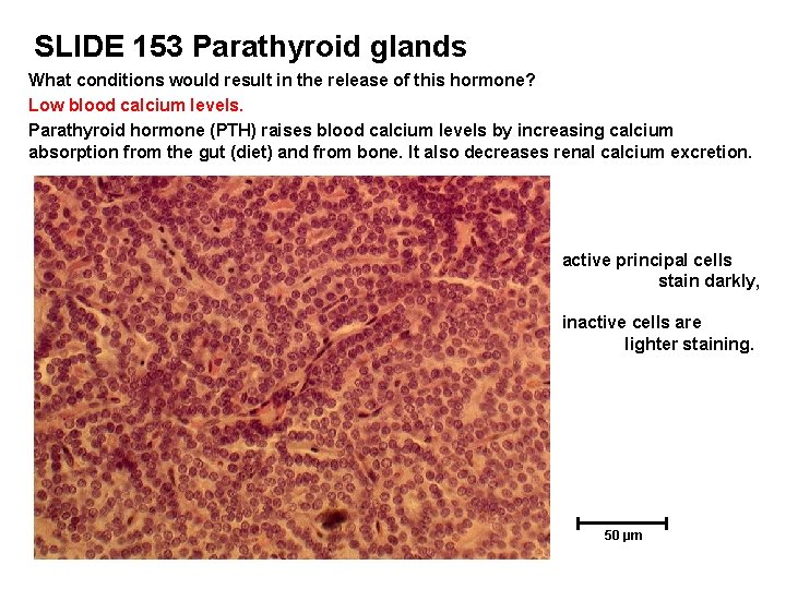 SLIDE 153 Parathyroid glands What conditions would result in the release of this hormone?