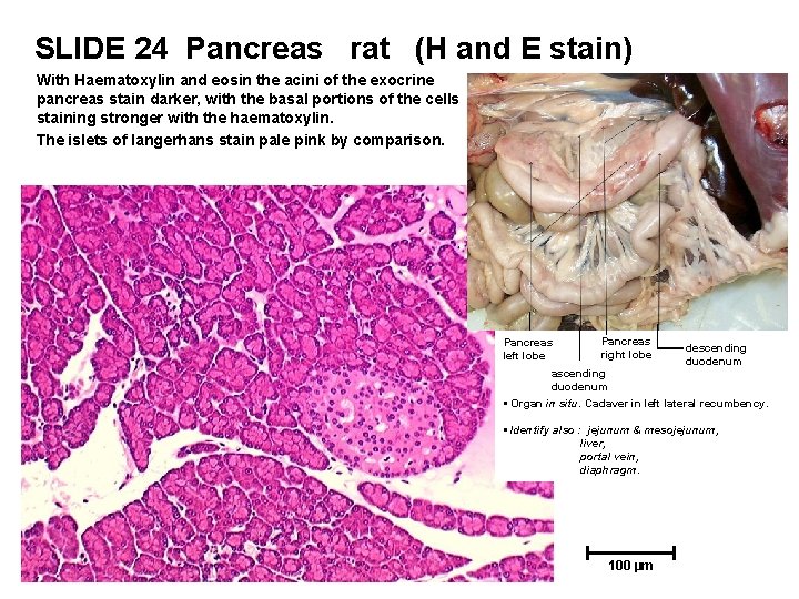 SLIDE 24 Pancreas rat (H and E stain) With Haematoxylin and eosin the acini