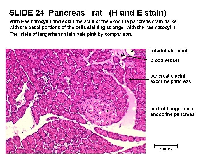 SLIDE 24 Pancreas rat (H and E stain) With Haematoxylin and eosin the acini