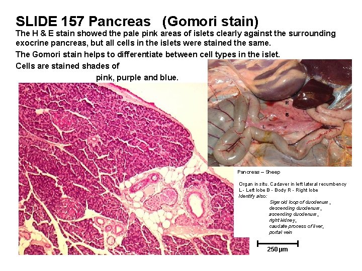 SLIDE 157 Pancreas (Gomori stain) The H & E stain showed the pale pink